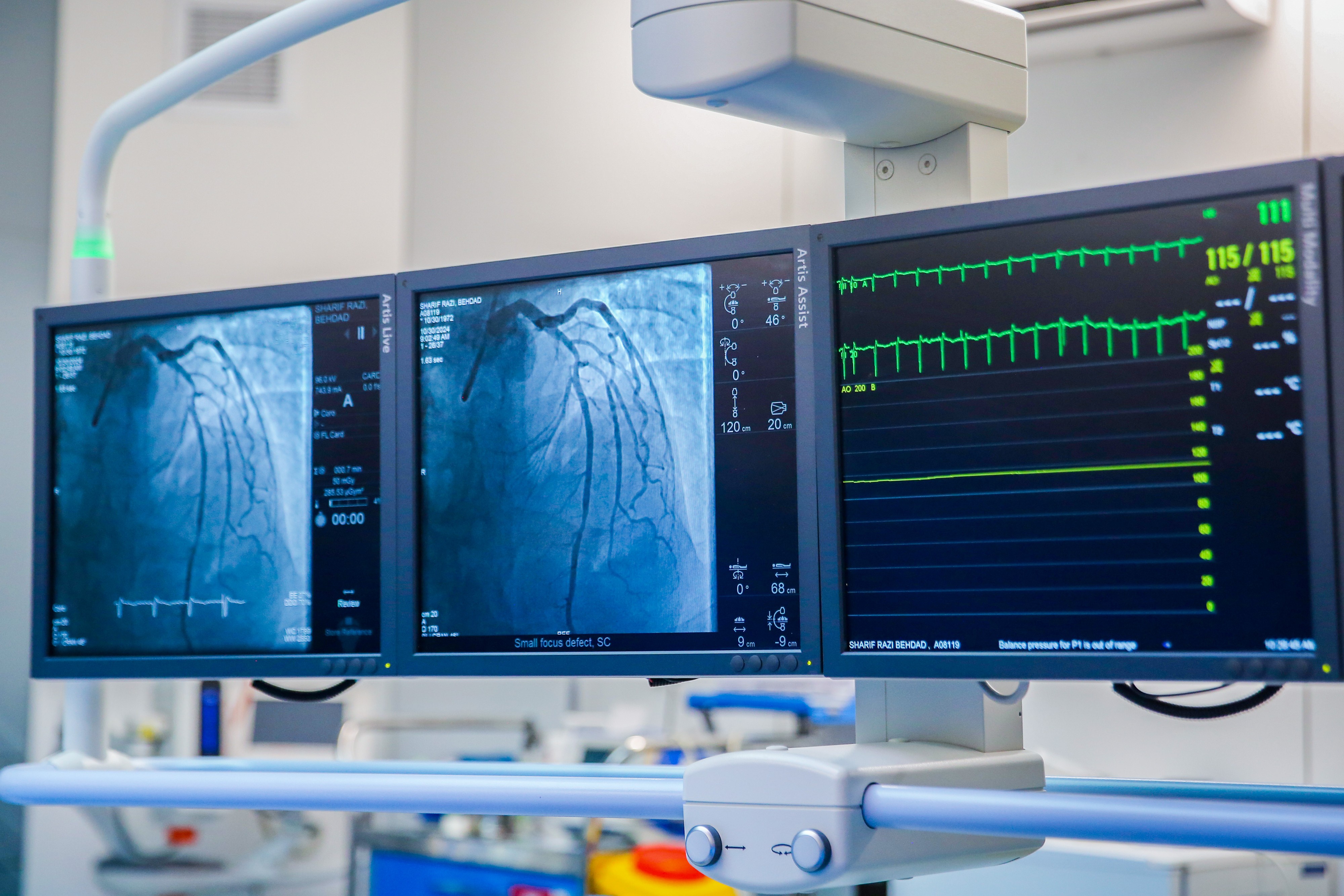 Three medical monitors display angiogram images of the heart alongside a patient's heart rhythm and vital signs.