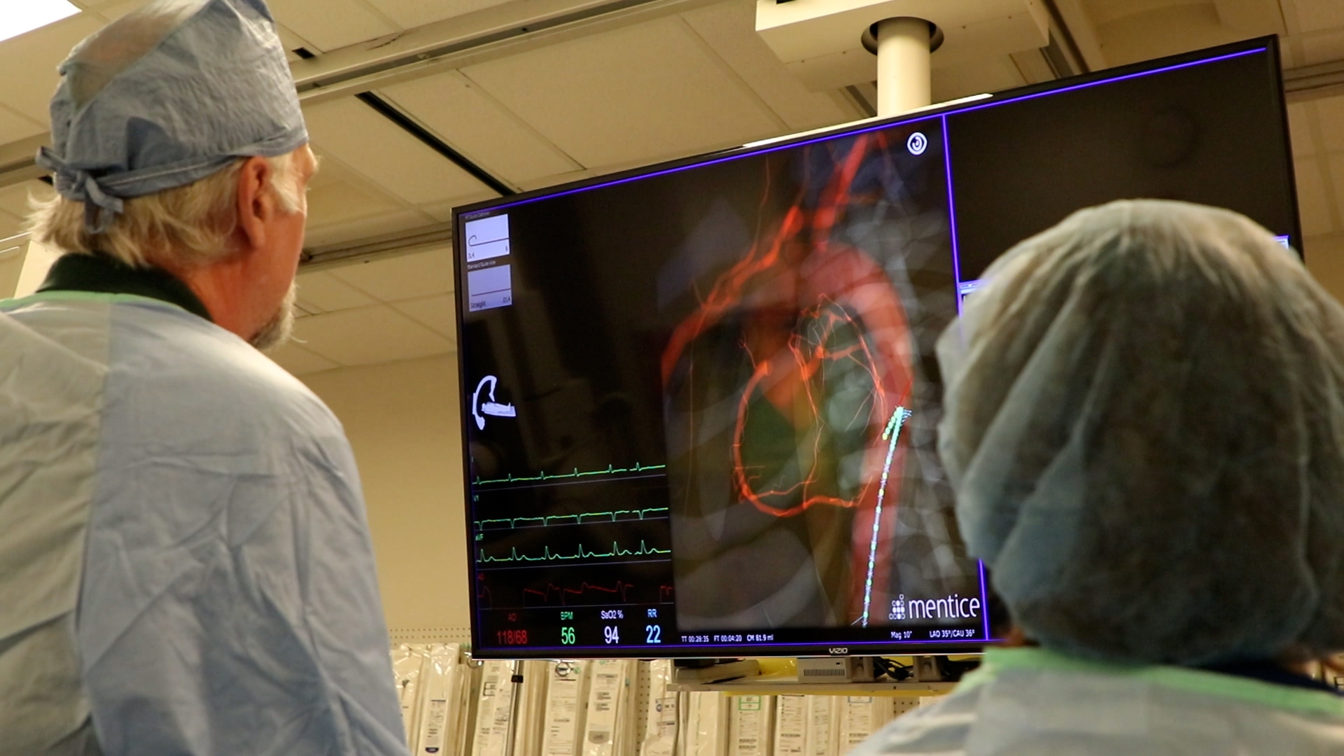 Instructor and participant in surgical attire view a cardiovascular simulation displaying a catheter-based procedure.